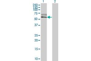 Western Blot analysis of ACVRL1 expression in transfected 293T cell line by ACVRL1 monoclonal antibody (M06), clone 2C12. (ACVRL1 抗体  (AA 22-119))