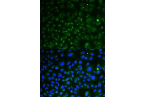Immunofluorescence analysis of HeLa cells using LAMP1 antibody (ABIN5998110). (LAMP1 抗体)