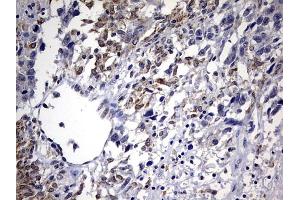 Immunohistochemistry (IHC) image for anti-ATP-Binding Cassette, Sub-Family D (Ald), Member 1 (ABCD1) (AA 508-745) antibody (ABIN2715622) (ABCD1 抗体  (AA 508-745))