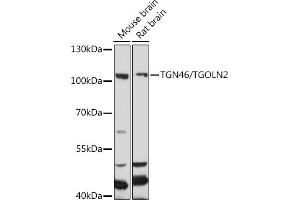 Western blot analysis of extracts of various cell lines, using TGN46/TGN46/TGOLN2 antibody (ABIN7270876) at 1:1000 dilution. (TGOLN2 抗体)