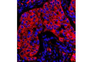 Immunofluorescence (IF) image for anti-Chloride Intracellular Channel 6 (CLIC6) antibody (ABIN7073478)