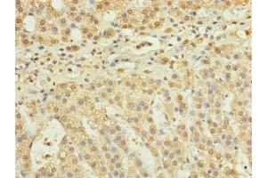 Immunohistochemistry of paraffin-embedded human adrenal gland tissue using ABIN7168124 at dilution of 1:100