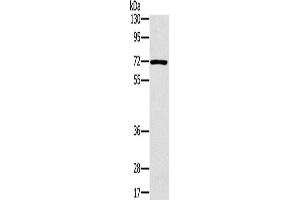 Western Blotting (WB) image for anti-Plastin 3 (PLS3) antibody (ABIN2423979) (Plastin 3 抗体)