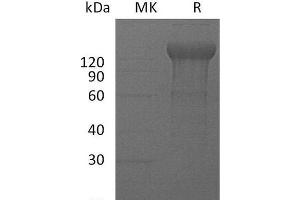 Western Blotting (WB) image for Interleukin 12 Receptor, beta 2 (IL12RB2) protein (Fc Tag) (ABIN7320555) (IL12RB2 Protein (Fc Tag))