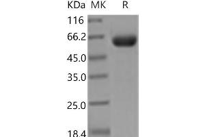Western Blotting (WB) image for EPH Receptor A7 (EPHA7) (Active) protein (His tag) (ABIN7195538)