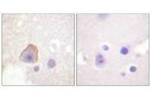 Immunohistochemical analysis of paraffin-embedded human brain tissue using ADD1 (Ab-726) antibody.