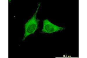 Immunofluorescence of monoclonal antibody to BRAF on HeLa cell. (BRAF 抗体  (AA 138-231))