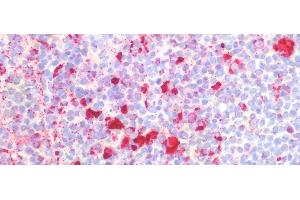 Immunohistochemistry (IHC) image for anti-Prosaposin (PSAP) (AA 17-524) antibody (ABIN7435130)