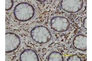 Immunoperoxidase of monoclonal antibody to CALR on formalin-fixed paraffin-embedded human colon tissue. (Calreticulin 抗体  (AA 1-417))