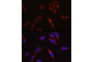 Immunofluorescence (IF) image for anti-SECIS Binding Protein 2 (SECISBP2) (AA 585-854) antibody (ABIN6147497)
