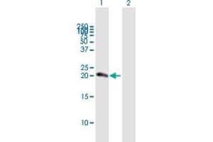Western Blotting (WB) image for anti-Nudix (Nucleoside Diphosphate Linked Moiety X)-Type Motif 10 (NUDT10) (AA 1-164) antibody (ABIN949893)