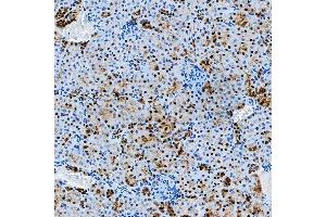 IHC analysis of SF3A3 using anti-SF3A3 antibody (ABIN7599863).
