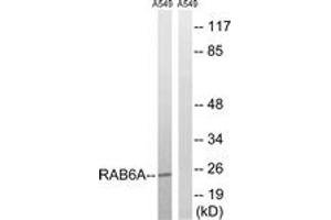 Western blot analysis of extracts from A549 cells, using RAB6A Antibody. (RAB6A 抗体  (AA 113-162))