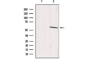 Western blot analysis of extracts from rat brain, using PSAP Antibody. (Prosaposin 抗体  (Internal Region))
