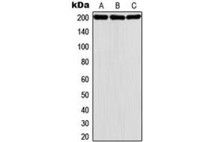 Western blot analysis of MADD expression in HeLa (A), A431 (B), K562 (C) whole cell lysates. (MADD 抗体  (Center))