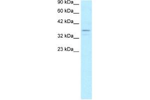 Western Blotting (WB) image for anti-TAF7 RNA Polymerase II, TATA Box Binding Protein (TBP)-Associated Factor, 55kDa (TAF7) (N-Term) antibody (ABIN2774669)