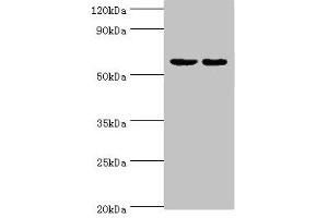 Western blot All lanes: Diacylglycerol kinase epsilon antibody at 5 μg/mL Lane 1: Rat brain tissue Lane 2: Hela whole cell lysate Secondary Goat polyclonal to rabbit IgG at 1/10000 dilution Predicted band size: 64, 21 kDa Observed band size: 64 kDa (DGKE 抗体  (AA 40-260))