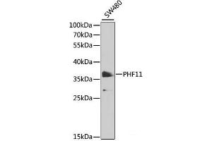 Western blot analysis of extracts of SW480 cells using PHF11 Polyclonal Antibody at dilution of 1:1000. (PHF11 抗体)