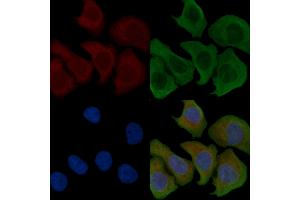 ABIN6258241 and ABIN6274503 staining Hela cells by IF/ICC. (ILKAP 抗体  (N-Term))