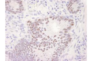 anti-Cyclin-Dependent Kinase 11B (CDK11B) (C-Term) antibody