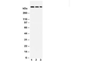 Western blot testing of LAMA2 antibody and Lane 1:  HeLa (Laminin 抗体  (AA 152-170))