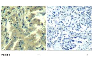 Image no. 1 for anti-Phospholipase C gamma 2 (PLCG2) (Tyr1217) antibody (ABIN319402) (Phospholipase C gamma 2 抗体  (Tyr1217))