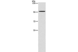 Western Blot analysis of A172 cell using PDE6C Polyclonal Antibody at dilution of 1:1400 (PDE6C 抗体)