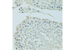 Immunohistochemistry of paraffin-embedded rat testis using BRD3 antibody (ABIN6003514) at dilution of 1/100 (40x lens). (BRD3 抗体)
