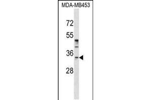Western blot analysis in MDA-MB453 cell line lysates (35ug/lane). (POU6F1 抗体  (N-Term))