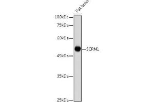 Western blot analysis of extracts of Rat brain , using SCRN1 antibody (ABIN7270175) at 1:1000 dilution. (Secernin 1 抗体)