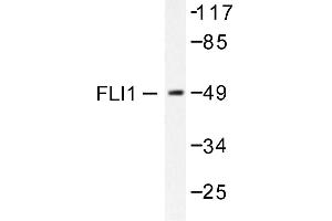 Image no. 1 for anti-Friend Leukemia Virus Integration 1 (FLI1) antibody (ABIN265422) (FLI1 抗体)