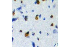 Immunohistochemical analysis of ZFP95 staining in human brain formalin fixed paraffin embedded tissue section. (ZKSCAN5 抗体)