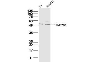 Lane 1: TT lysates Lane 2: hepg2 lysates probed with ZNF763 Polyclonal Antibody, Unconjugated  at 1:300 dilution and 4˚C overnight incubation. (ZNF763 抗体  (AA 301-394))