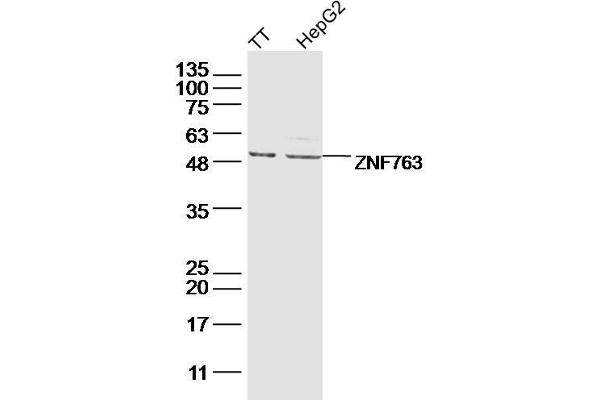 ZNF763 Antikörper  (AA 301-394)