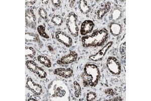 Immunohistochemical staining of human kidney with KCNE3 polyclonal antibody  shows strong cytoplasmic positivity in granular pattern in tubular cells at 1:500-1:1000 dilution. (Kcne3 抗体)
