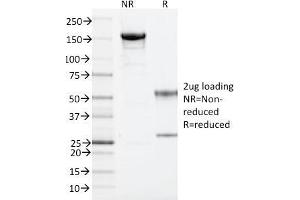 SDS-PAGE Analysis Purified ARF1 Mouse Monoclonal Antibody (ARF1/2117). (ARF1 抗体)