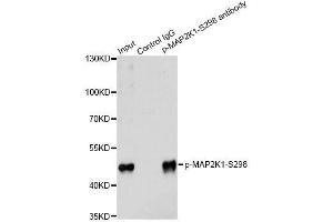 Immunoprecipitation analysis of 200 μg extracts of 293 cells treated by PMA using 2. (MEK1 抗体  (pSer297))