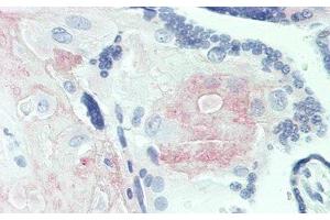 Detection of FGL2 in Human Placenta Tissue using Polyclonal Antibody to Fibrinogen Like Protein 2 (FGL2) (FGL2 抗体  (AA 20-432))
