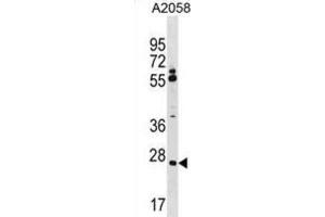 Western Blotting (WB) image for anti-Canopy 3 Homolog (CNPY3) antibody (ABIN5019952) (TNRC5 抗体)