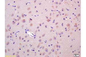 Formalin-fixed and paraffin embedded rat brain labeled with Anti-Wnt1 Polyclonal Antibody, Unconjugated (ABIN733748) at 1:200 followed by conjugation to the secondary antibody and DAB staining.