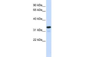 WB Suggested Anti-NFKBIA Antibody Titration:  0. (NFKBIA 抗体  (Middle Region))