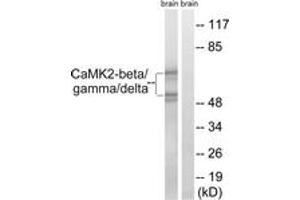 Western blot analysis of extracts from rat brain cells, using CaMK2-beta/gamma/delta (Ab-287) Antibody. (CaMK2 beta/gamma/delta (AA 253-302) 抗体)