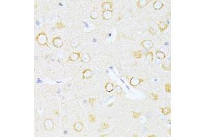 Immunohistochemistry of paraffin-embedded rat brain using Casp8 antibody. (Caspase 8 抗体)