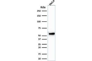 Western Blot Analysis of human HeLa cell lysate using Cytokeratin 7 Mouse Monoclonal Antibody (KRT7/1198). (Cytokeratin 7 抗体)