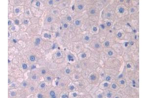 Detection of LCAT in Human Liver Tissue using Polyclonal Antibody to Lecithin Cholesterol Acyltransferase (LCAT) (LCAT 抗体  (AA 290-433))