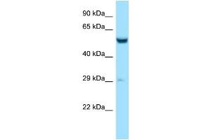 Western Blotting (WB) image for anti-Zinc Finger CCCH-Type Containing 10 (ZC3H10) (N-Term) antibody (ABIN2788533) (ZC3H10 抗体  (N-Term))