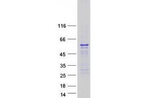 Western Blotting (WB) image for Src Kinase Associated phosphoprotein 1 (SKAP1) (Transcript Variant 2) protein (Myc-DYKDDDDK Tag) (ABIN2731440)