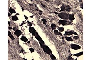 IHC on rat DRG (free floating cryo section) using rabbit SORT1 polyclonal antibody  at a dilution of 1 : 1000. (Sortilin 1 抗体)