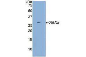Western blot analysis of recombinant Rat TLR4. (TLR4 抗体  (AA 49-247))