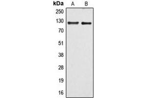 Western blot analysis of ARHGEF1 expression in HuvEc (A), Raw264.